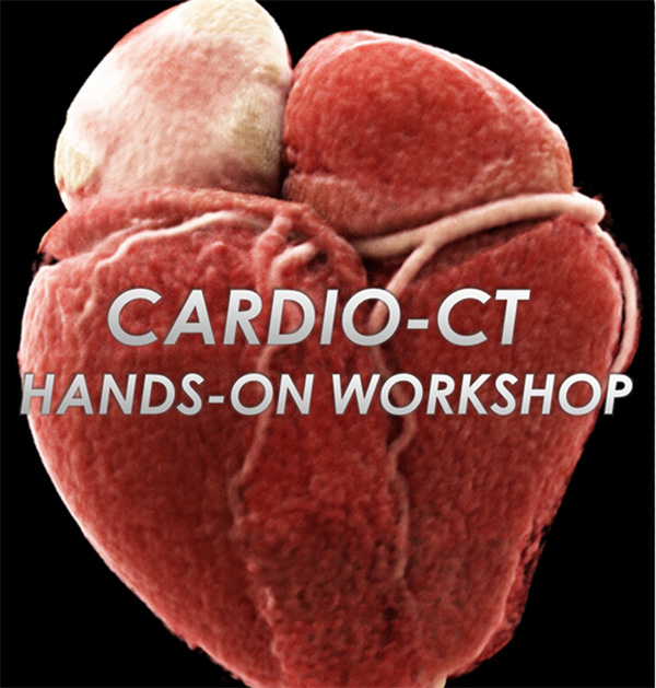 Cardio-CT Hands-on-Workshop