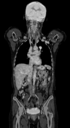 Lehrmodul Computertomographie