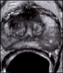 endo01.jpg