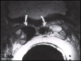 endo03.jpg