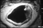 endo07.jpg