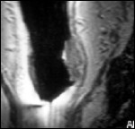 endo08.jpg