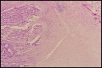 endo09.jpg
