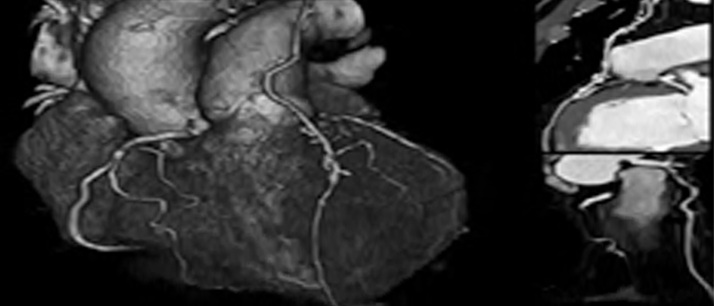 Computed Tomography of the heart